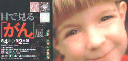 gan-ten.jpg (12714 �o�C�g)