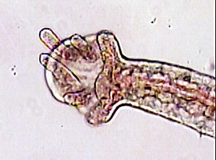 branchial fossa