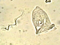 vorticella 60KB