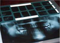 �����g�Q��