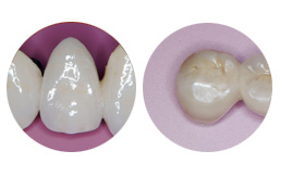 �Z���~�b�N�̎ʐ^